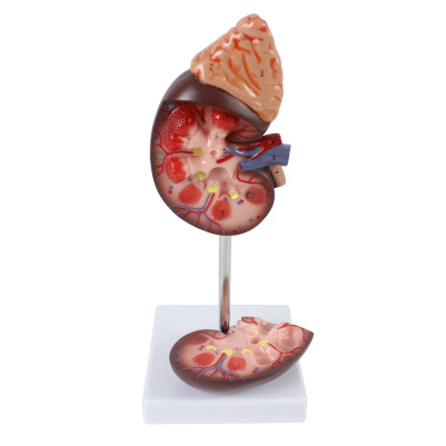 Human Kidney with Adrenal Gland Model 1.5X Enlarged